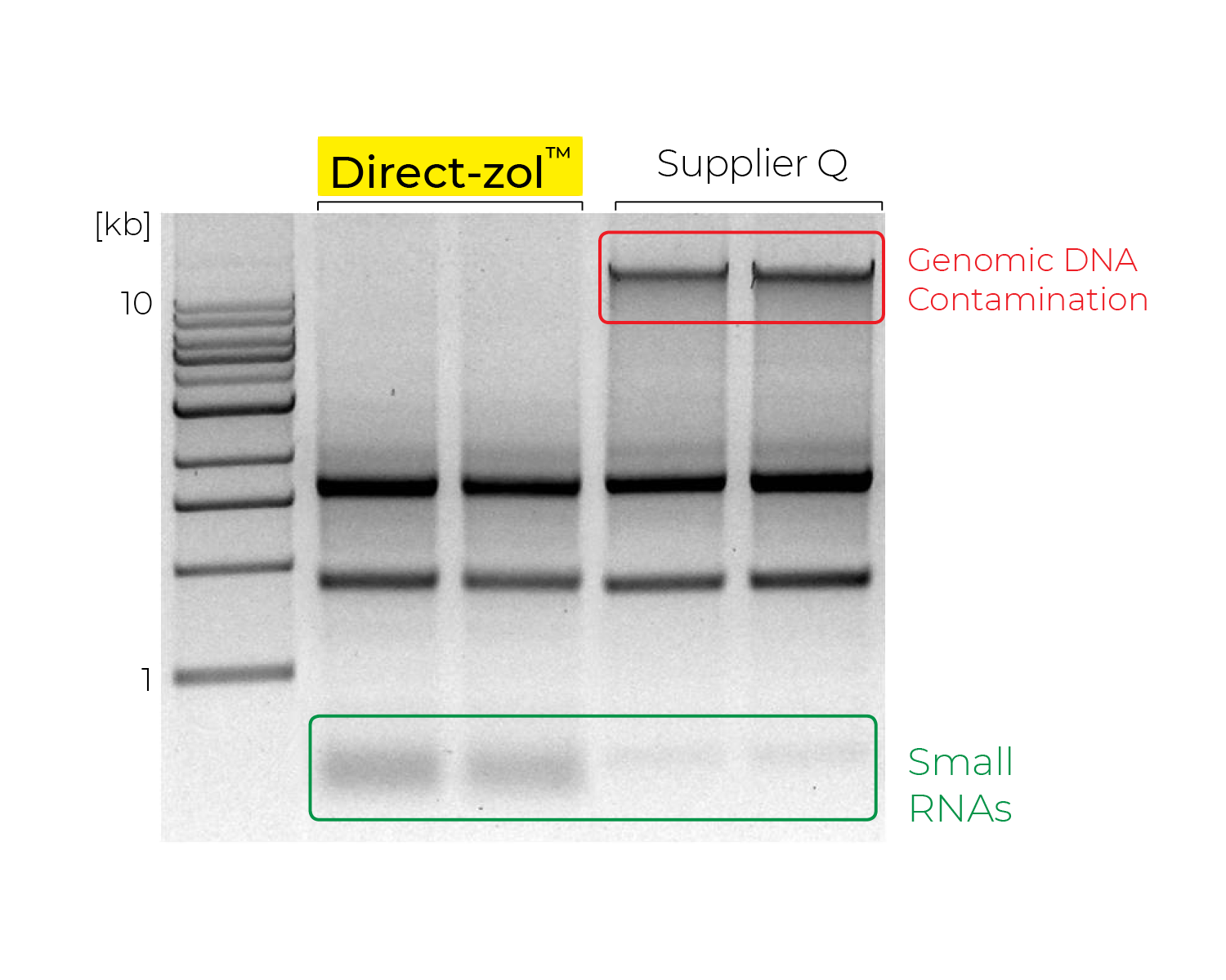 DNA gel electrophoresis