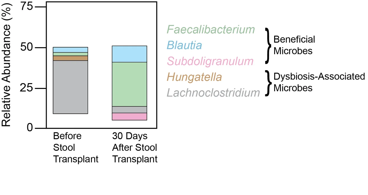 Stacked bar plots that summarize one of Dr. Fernandez’s findings. The relative abundances of a subset of species found in the gut microbiome of bone marrow transplant patients both before and after a stool transplant are shown.