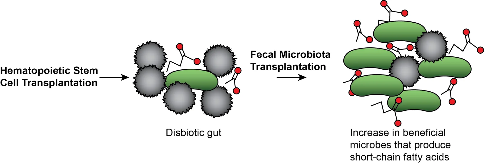An illustration showing the hypothesis of Dr. Fernandez’s grant-winning project, where beneficial microbes that produce short-chain fatty acids are in green and opportunistic bacteria are in grey.