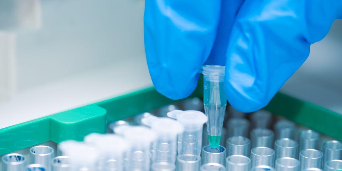 A scientist placing PCR tubes in PCR machine to amplify a specific DNA sequence for downstream analysis. 