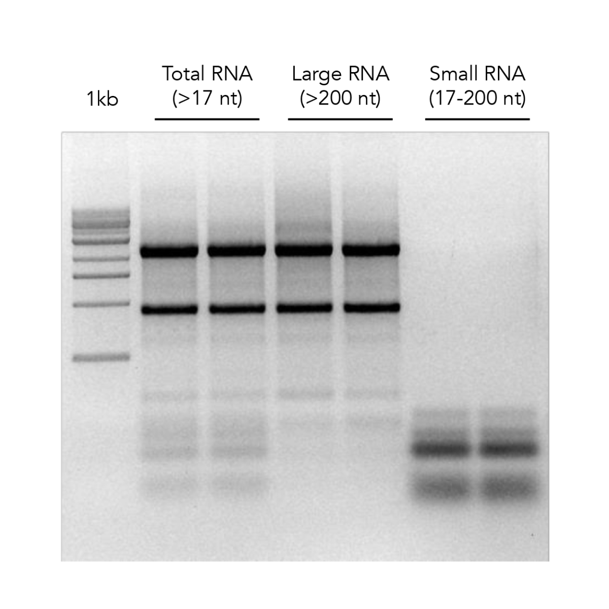 RNA gel electrophoresis