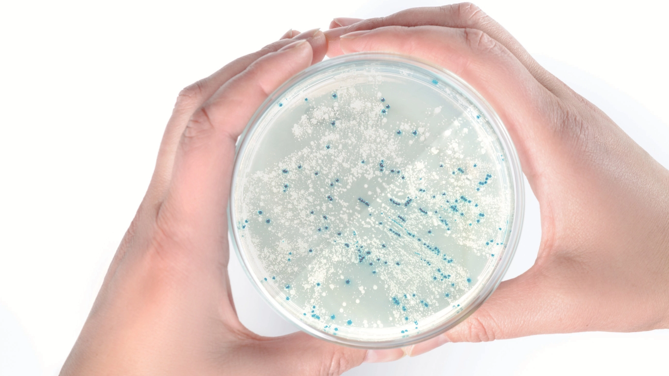 A scientist's hands holding a culture plate used for bacterial transformation, illustrating that Mix & Go! Competent Cells transform <i>E. coli</i> in 20 seconds without heat shock, lengthy incubations, or outgrowth.