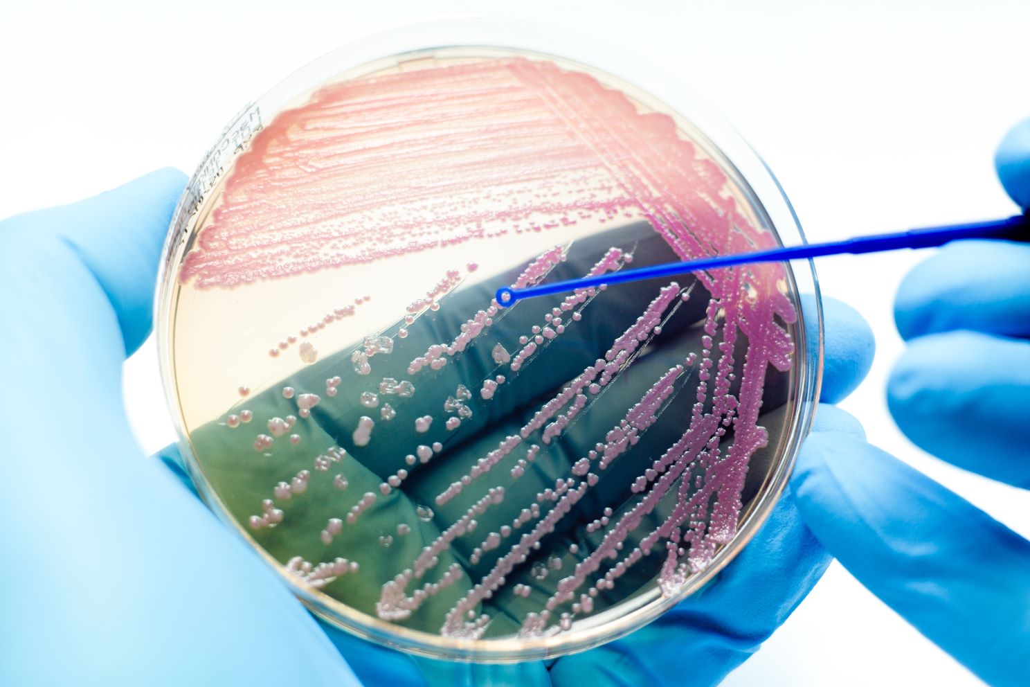 A scientist wearing blue gloves holds a petri dish with bacterial colonies grown on agar, using an inoculation loop to examine the samples