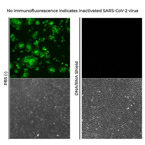 image showing the inactivation of SARS-CoV-2 virus due to lack of immunofluorescense