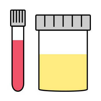 image of blood and urine sample containers