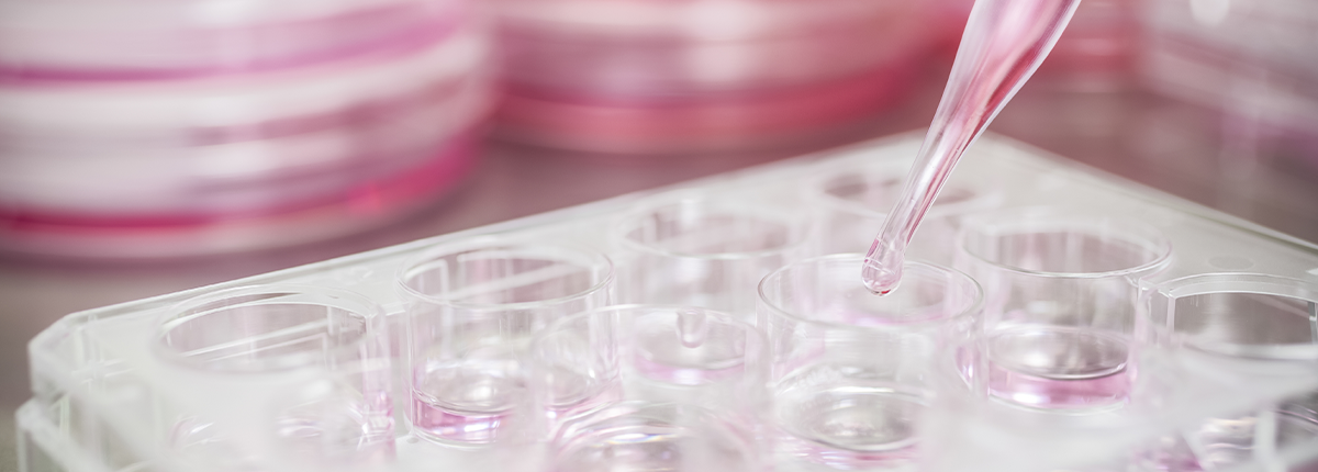 Transfection-grade Plasmid DNA