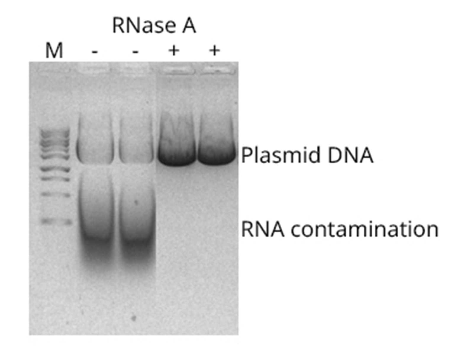 Plasmid Purified using plasmid miniprep
