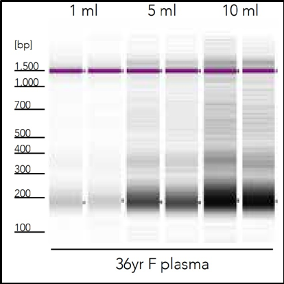 DNA gel