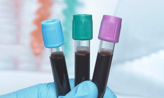 Quick-DNA/RNA Blood Tube Kit
