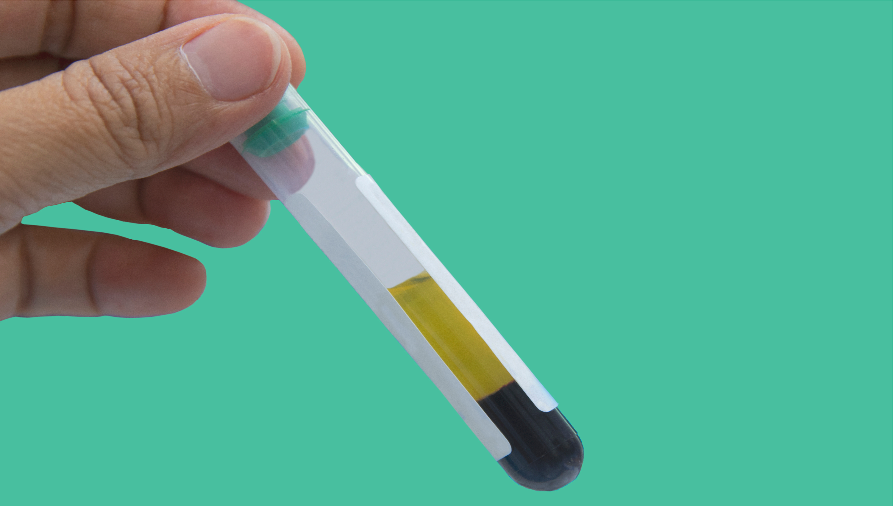 Hand holding tube for liquid biopsy